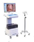 GC-3000E（SD) Digital colposcope Vagina Examination Colposcope for colposcope