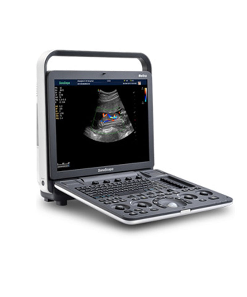 Sonoscape S8exp  portable ultrasound color doppler machine ultrasound scanner