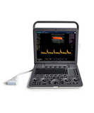 Sonoscape S8exp  portable ultrasound color doppler machine ultrasound scanner