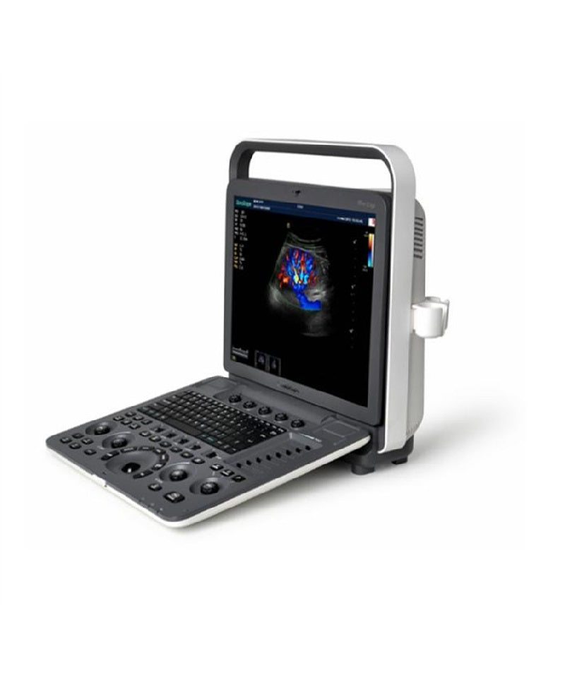 Sonoscape S8exp  portable ultrasound color doppler machine ultrasound scanner