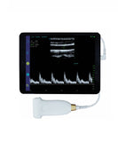 UL10-5E  handheld ultrasound machine Linear probe