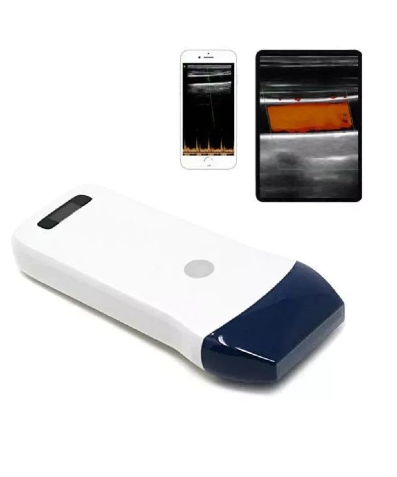 UProbe-C5C Portable Handheld Wireless Ultrasound Scanner